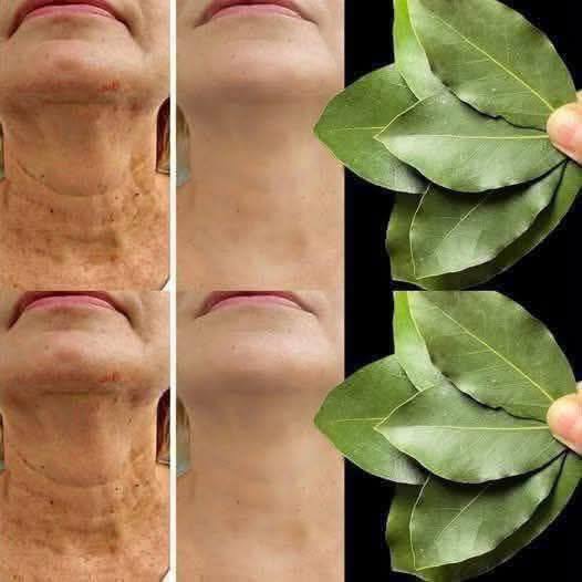 Bay Leaf The Natural Wrinkle Eraser for Ageless Beauty